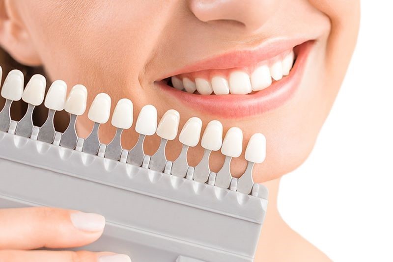 Bọc răng sứ thẩm mỹ đang là xu hướng chỉnh trang nụ cười được nhiều người yêu thích. 